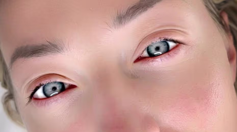 Before lash lift